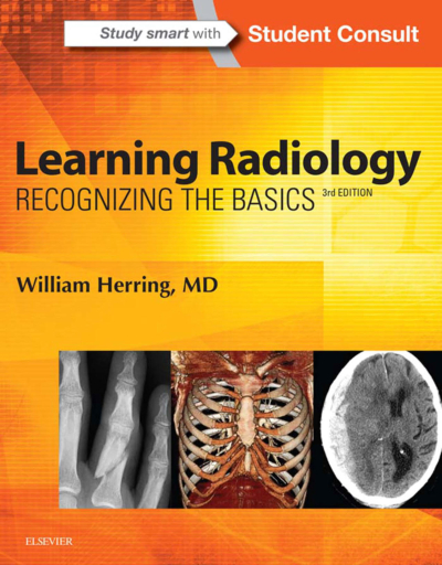 Learning Radiology: Recognizing The Basics / William Herring Vega Efsanesi